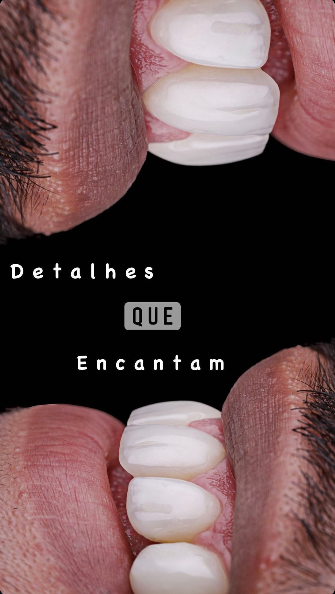 Detalhes de facetas em fundo preto