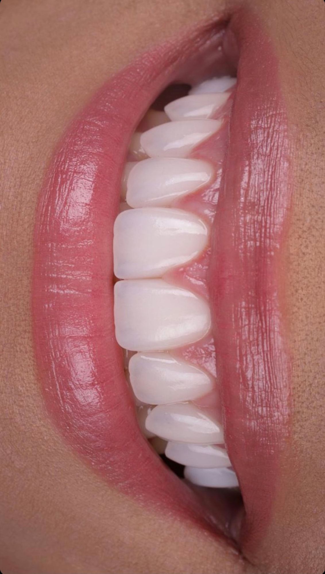 Sorriso em macro