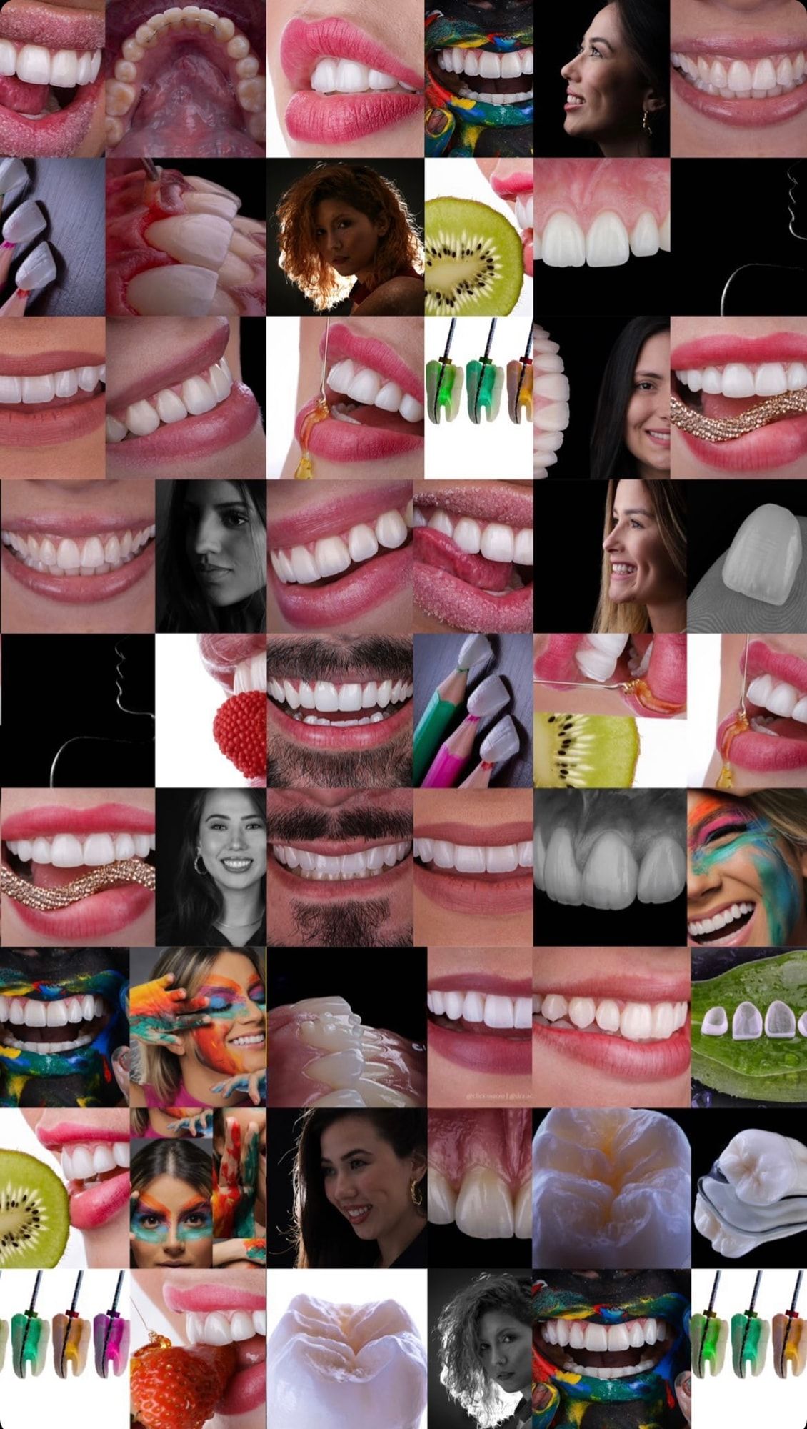 Mosaico de fotografias odontológicas